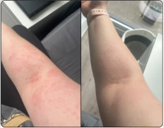 Before and after — Toni Jones