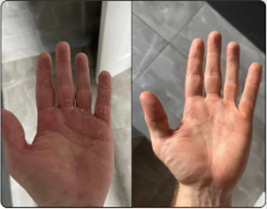 Before and after — Simon Brown